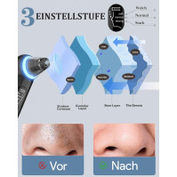 2023 Nejnovější odsávač porů sada na odstranění černých teček, odsávač porů, čistič pórů na akné, odsávač na akné, USB