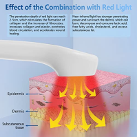 iKeener Red Light Therapy Device, schválená FDA ruční studená laserová terapie proti bolesti, nízkoúrovňové infračervené světlo 