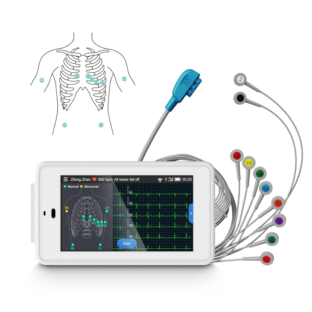 Profesionální 12kanálový EKG přístroj Wellue PG12, digitální EKG monitor s algoritmem Glasgow, podpora pro akvizici a analýzu EK