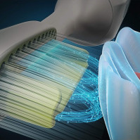 Silk'n ToothWave - Elektrický zubní kartáček - profesionální čištění zubů - technologie DentalRF™ - bílý - 1 kus